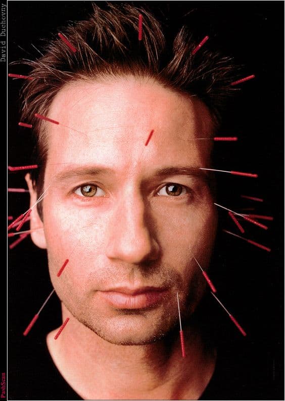 Acupuncture Esthétique